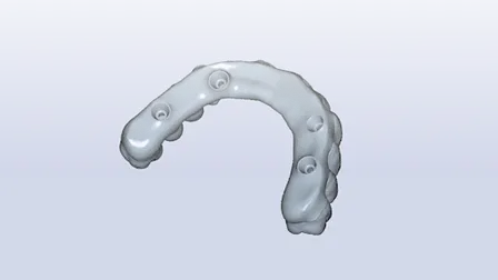 Best Practices for Digital Full Arch