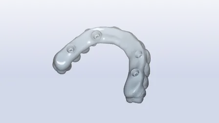 Best Practices for  Digital Full Arch