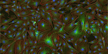 MNB: Essentials in Microscopy - From sample preparation to fluorescence